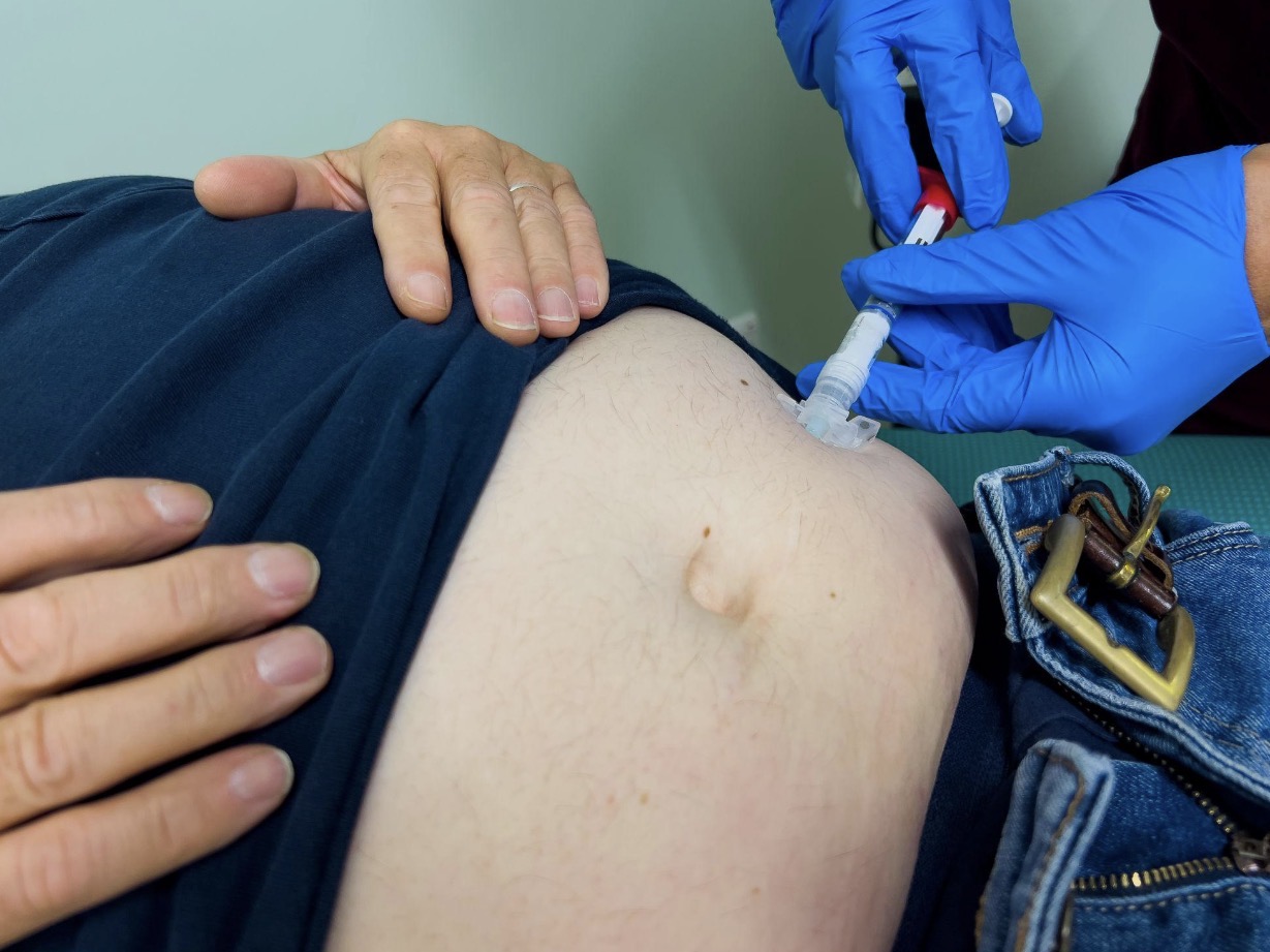 Hormone therapy