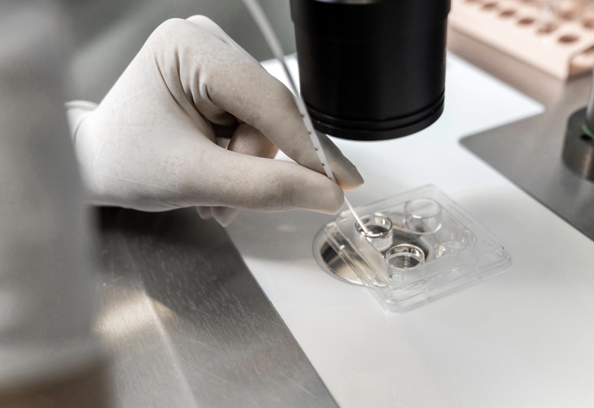 IVF (In-Vitro Fertilisation)